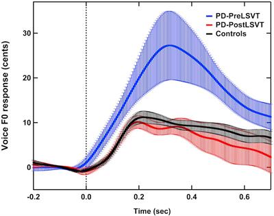 Neurobehavioral Effects of LSVT® LOUD on Auditory-Vocal Integration in Parkinson’s Disease: A Preliminary Study